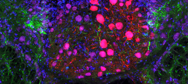 Serotonin - immunoreactive fibers (green) contacting neurobiotin (red)-filled vocal motor neurons (pink)  in a transverse section through the hindbrain-spinal cord of a plainfin midshipman fish.