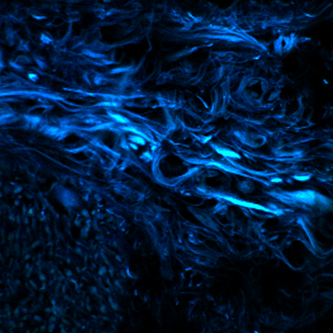 A fluorescent dye shows amyloid proteins on the surface of fungal hyphae during an invasive gut infection.